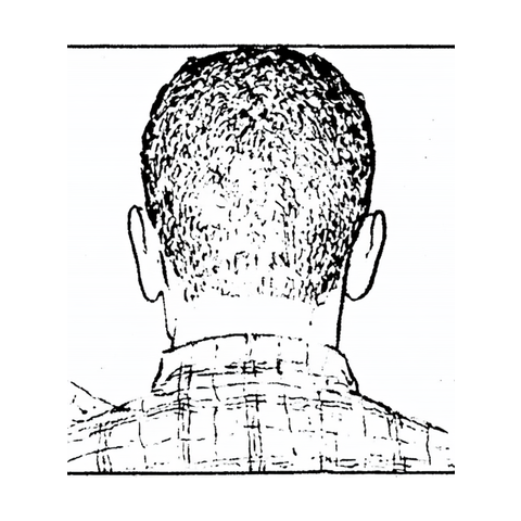 Reference drawing — back view of a man's head for hair-transplant photos