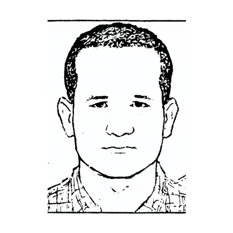 Reference drawing — front view of a man's head for hair-transplant photos