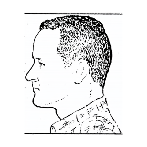 Reference drawing — left view of a man's head for hair-transplant photos