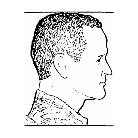 Reference drawing — right view of a man's head for hair-transplant photos