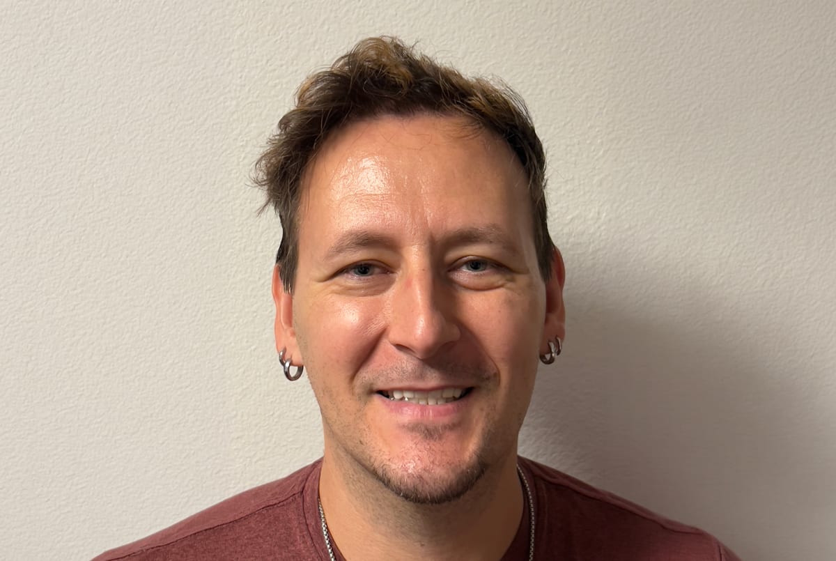 Daniel after hair transplant (unedited)