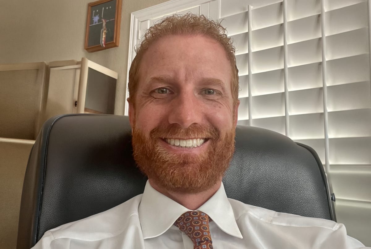 James after hair transplant (unedited)