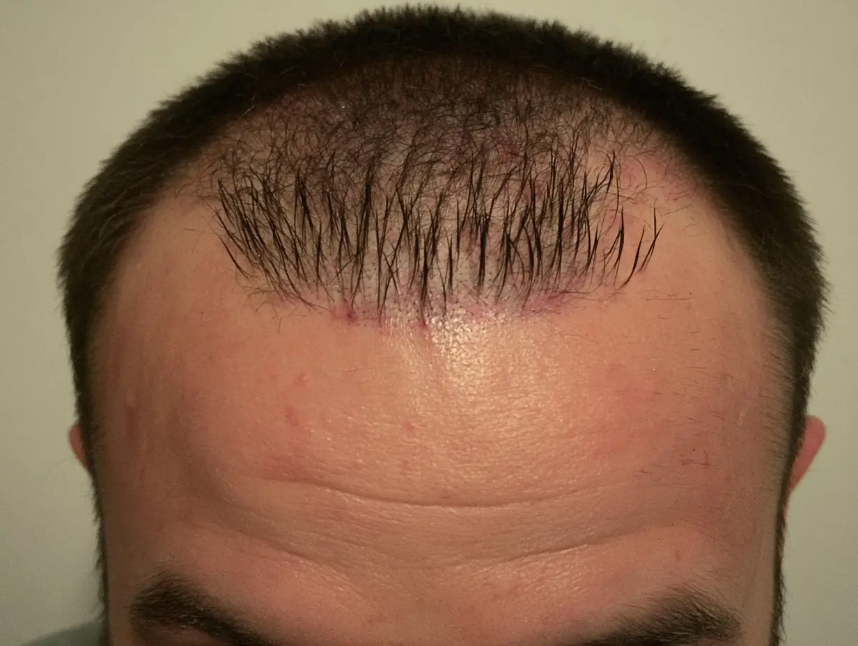 Corrective — clinical/technique image for Corrective & Repair